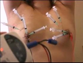 Japanese Needle Electro Torture