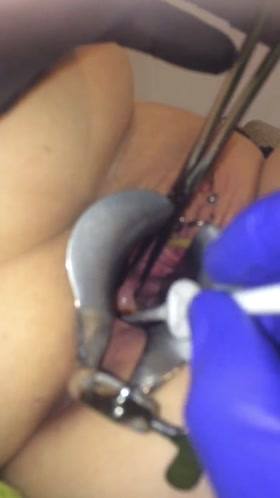 Needle Play – Cervix Extreme Gyno Play
