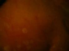 Wax play – Amateur
