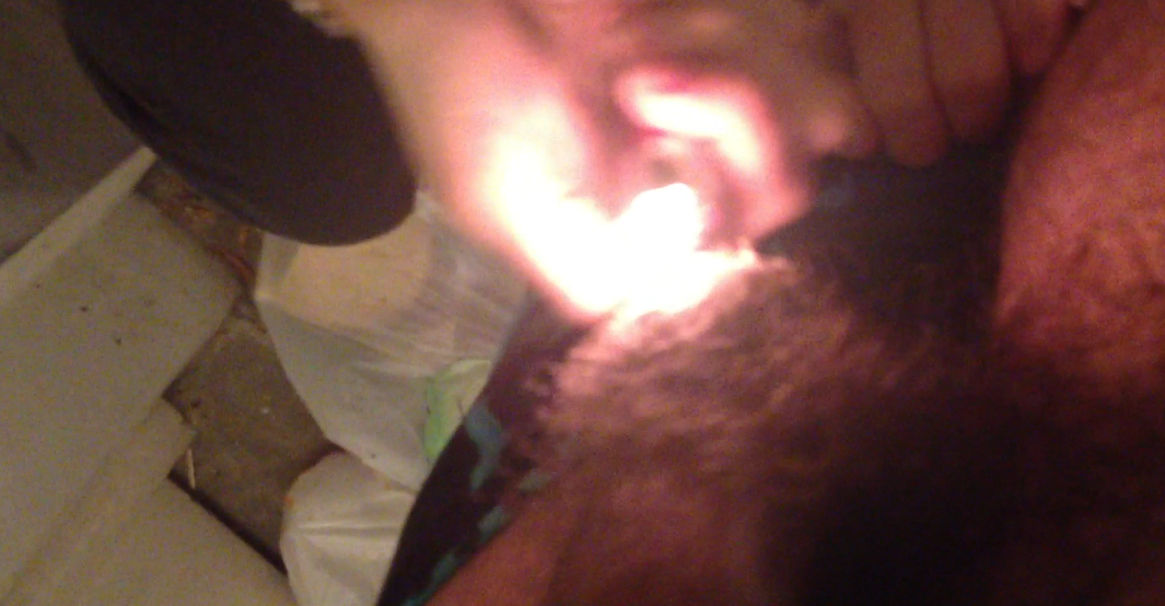 Burning his balls